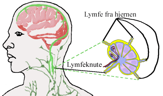 Soneterapi og hjernens lymfesystem