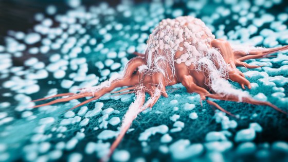 Kreftsvulster inneholder bakterier og sopp